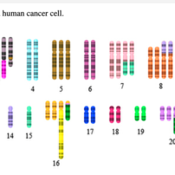 The figure shows the karyogram of a human cancer cell